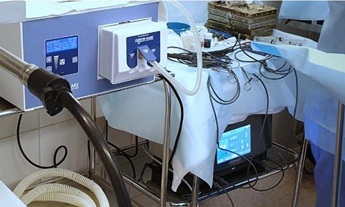 2-я апробация аппарата RadioSURG ® 2200, Германия